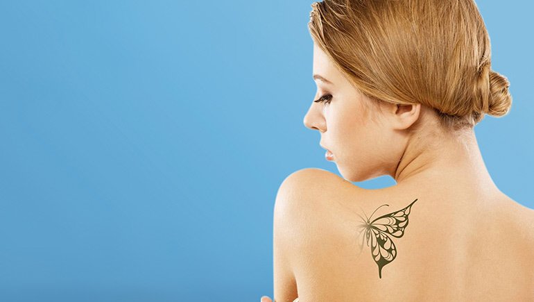 Get Tattoo Removed With The Best Tattoo Removal Clinic in Kota