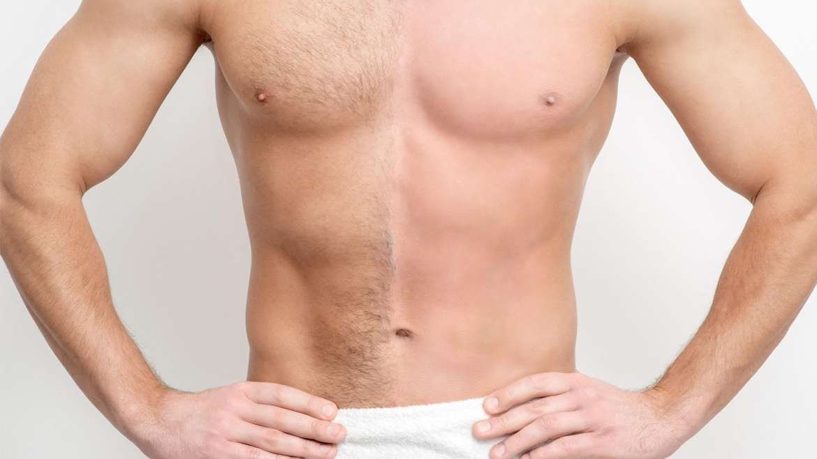 PERMANENT PAINLESS HAIR REMOVAL (DIODE LASER)